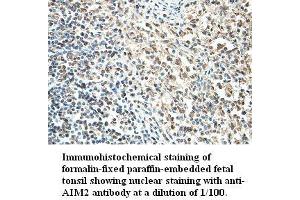 Image no. 1 for anti-Absent in Melanoma 2 (AIM2) antibody (ABIN791198) (AIM2 抗体)