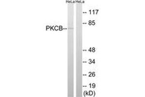 Western blot analysis of extracts from HeLa cells, using PKCB (Ab-661) Antibody. (PKC beta 抗体  (AA 622-671))