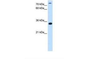 Image no. 1 for anti-TAM41, Mitochondrial Translocator Assembly and Maintenance Protein (TAMM41) (N-Term) antibody (ABIN341337) (TAM41 抗体  (N-Term))