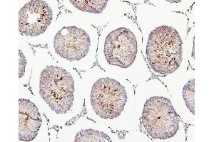 IHC analysis of TEK using anti-TEK antibody (ABIN7600762). (TEK 抗体  (AA 23-616))