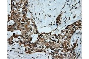 Immunohistochemical staining of paraffin-embedded Kidney tissue using anti-SRR mouse monoclonal antibody. (SRR 抗体)