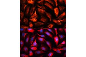 Immunofluorescence analysis of U2OS cells using MB antibody (ABIN1680748, ABIN3017668, ABIN3017669 and ABIN6220205) at dilution of 1:100. (MAP1B 抗体  (AA 1820-2100))