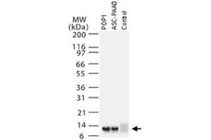 Western blot analysis of PYDC1 using PYDC1 polyclonal antibody  at 1 : 2000.