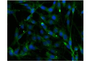 Immunofluorescence (IF) image for anti-Phospholipase C beta 4 (PLCb4) (AA 752-961) antibody (ABIN968583) (Phospholipase C beta 4 抗体  (AA 752-961))