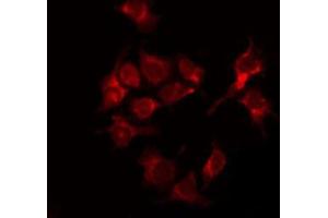 ABIN6267543 staining 293 by IF/ICC. (Tuberin 抗体  (pThr1462))