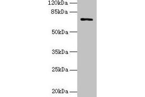 Western blot All lanes: SLC6A6 antibody at 0. (TAUT 抗体  (AA 1-49))