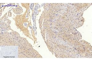 Immunohistochemical analysis of paraffin-embedded mouse heart tissue. (PIK3R1 抗体  (pTyr607))