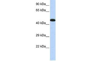 Human Muscle; WB Suggested Anti-AKAP5 Antibody Titration: 0.