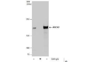 IP Image Immunoprecipitation of ROCK2 protein from HeLa whole cell extracts using 5 μg of ROCK2 antibody, Western blot analysis was performed using ROCK2 antibody, EasyBlot anti-Rabbit IgG  was used as a secondary reagent. (ROCK2 抗体)