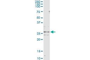 Immunoprecipitation of CFC1 transfected lysate using anti-CFC1 monoclonal antibody and Protein A Magnetic Bead , and immunoblotted with CFC1 MaxPab rabbit polyclonal antibody. (CFC1 抗体  (AA 27-93))