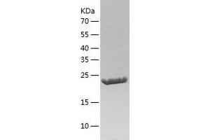 Western Blotting (WB) image for Nonhomologous End-Joining Factor 1 (NHEJ1) (AA 1-224) protein (His tag) (ABIN7124193) (NHEJ1 Protein (AA 1-224) (His tag))