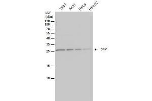 WB Image BNP antibody detects BNP protein by western blot analysis. (NPPB 抗体)