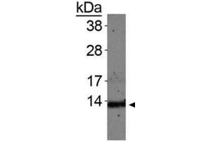 Western Blotting (WB) image for anti-Histone H4 (meLys20) antibody (ABIN5706797)