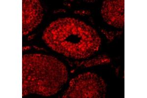 anti-SUMO1 Activating Enzyme Subunit 1 (SAE1) (AA 33-299) antibody