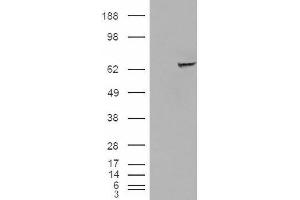 Image no. 2 for anti-Insulin-Like Growth Factor 2 mRNA Binding Protein 2 (IGF2BP2) (C-Term) antibody (ABIN374940) (IGF2BP2 抗体  (C-Term))
