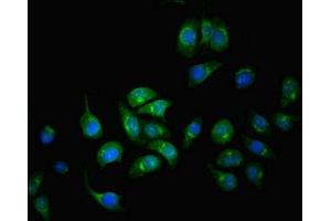 Immunofluorescent analysis of A549 cells using ABIN7148620 at dilution of 1:100 and Alexa Fluor 488-congugated AffiniPure Goat Anti-Rabbit IgG(H+L) (SERPINA6 抗体  (AA 136-405))