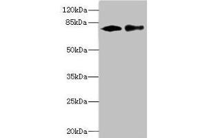 Western blot All lanes: CALCOCO1 antibody at 1. (CALCOCO1 抗体  (AA 462-691))