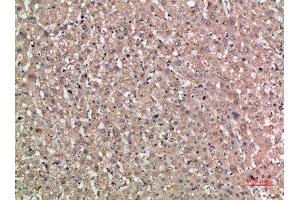 Immunohistochemical analysis of paraffin-embedded human-liver, antibody was diluted at 1:200 (NOG 抗体  (AA 21-70))
