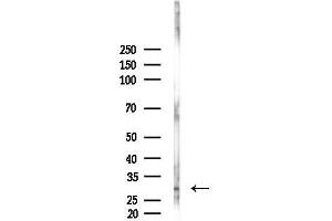 anti-Slow Skeletal Troponin T (TNNT1) (N-Term) antibody