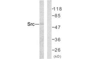 Western blot analysis of extracts from COLO205 cells, using Src (Ab-418) Antibody. (Src 抗体  (AA 386-435))