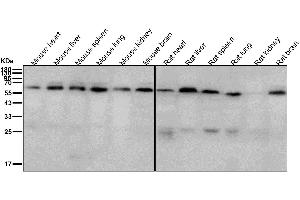 All lanes use the Antibody at 1:2K dilution for 1 hour at room temperature. (Recombinant ABCE1 抗体)