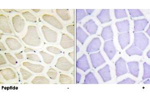 Immunohistochemistry analysis of paraffin-embedded human skeletal muscle tissue using COL20A1 polyclonal antibody . (COL20A1 抗体  (C-Term))