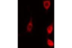 ABIN6278263 staining  NIH-3T3 cells by IF/ICC. (MAPKAP Kinase 2 抗体  (C-Term))