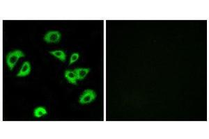 Immunofluorescence (IF) image for anti-Leukocyte Immunoglobulin-Like Receptor, Subfamily B (With TM and ITIM Domains), Member 4 (LILRB4) (Internal Region) antibody (ABIN1851488)