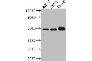 Western Blot Positive WB detected in: MCF-7 whole cell lysate, THP-1 whole cell lysate, HL-60 whole cell lysate All lanes: Vitamin D antibody at 1:1000 Secondary Goat polyclonal to rabbit IgG at 1/50000 dilution Predicted band size: 49, 54 kDa Observed band size: 49 kDa (Recombinant Vitamin D Receptor 抗体)