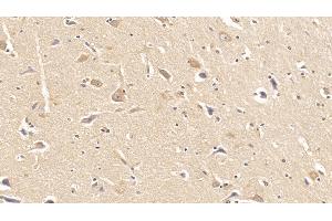 Detection of DMD in Human Cerebrum Tissue using Monoclonal Antibody to Dystrophin (DMD) (Dystrophin 抗体  (AA 253-597))