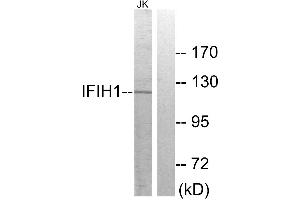 Western blot analysis of extracts from Jurkat cells, using IFIH1 antibody. (IFIH1 抗体)