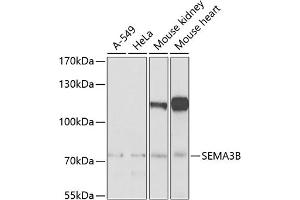 Western Blotting (WB) image for anti-Sema Domain, Immunoglobulin Domain (Ig), Short Basic Domain, Secreted, (Semaphorin) 3B (SEMA3B) (AA 569-748) antibody (ABIN6147511)