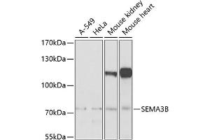 Western blot analysis of extracts of various cell lines, using SEMB Antibody (ABIN6132644, ABIN6147511, ABIN6147512 and ABIN6222774) at 1:1000 dilution. (SEMA3B 抗体  (AA 569-748))