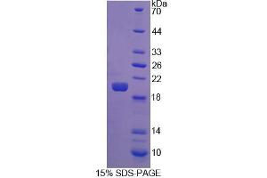 SDS-PAGE analysis of Human FGF22 Protein. (FGF22 蛋白)