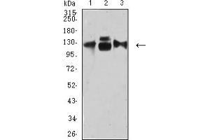 Western blot analysis using CD49C mouse mAb against HepG2 (1), HUVEC (2), and HUVE-12 (3) cell lysate. (ITGA3 抗体  (AA 63-248))