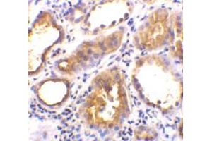 Immunohistochemical staining of human kidney tissue using AP30006PU-N ACE2 antibody at 2 μg/ml. (ACE2 抗体  (Intermediate Domain 1))