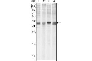 Western blot analysis using MCL1 mouse mAb against Hela (1), BCBL-1 (2), Jurkat (3) and HL60 (4) cell lysate. (MCL-1 抗体)