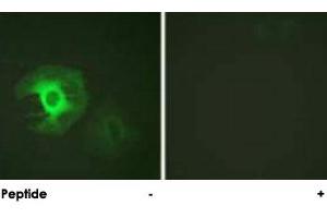 Immunofluorescence analysis of HeLa cells, using CALD1 polyclonal antibody .