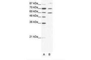 Image no. 1 for anti-Heat Shock Protein 90kDa alpha (Cytosolic), Class B Member 1 (HSP90AB1) (N-Term) antibody (ABIN202886)