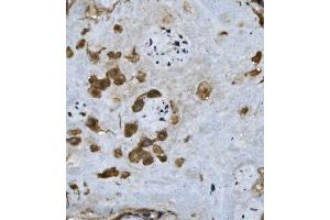 IHC analysis of FGA using anti-FGA antibody (ABIN7600004).
