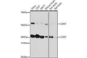 Western blot analysis of extracts of various cell lines, using CDK9 Rabbit mAb (ABIN7266597) at 1:1000 dilution.