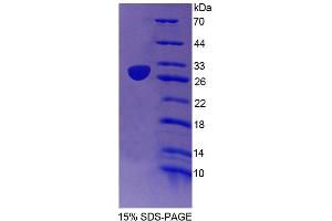 SDS-PAGE analysis of Mouse EMILIN2 Protein. (EMILIN2 蛋白)