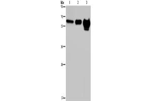 Western Blotting (WB) image for anti-Matrix Metalloproteinase 20 (MMP20) antibody (ABIN2435010) (MMP20 抗体)