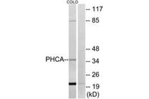 Western blot analysis of extracts from COLO cells, using PHCA Antibody. (ACER3 抗体  (AA 171-220))