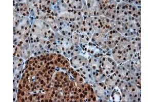 Immunohistochemical staining of paraffin-embedded Kidney tissue using anti-LTA4H mouse monoclonal antibody. (LTA4H 抗体)