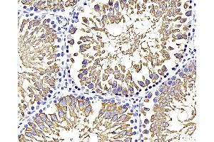 Immunohistochemistry analysis of paraffin-embedded rat testis using GLUT-3 Polyclonal Antibody at dilution of 1:400. (SLC2A3 抗体)