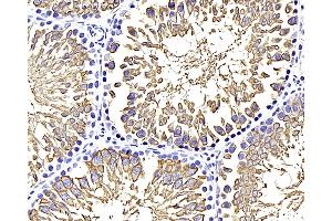 Immunohistochemistry (Paraffin-embedded Sections) (IHC (p)) image for anti-Solute Carrier Family 2 (Facilitated Glucose Transporter), Member 3 (SLC2A3) antibody (ABIN7249616)