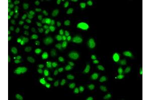 Immunofluorescence analysis of A549 cells using PIP4K2A antibody. (PIP4K2A 抗体)