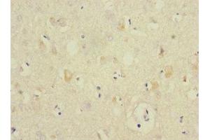 Immunohistochemistry of paraffin-embedded human brain tissue using ABIN7144207 at dilution of 1:100 (ANKS1B 抗体  (AA 999-1248))