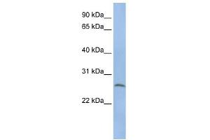 WB Suggested Anti-ELA1 Antibody Titration: 0. (CELA1 抗体  (N-Term))
